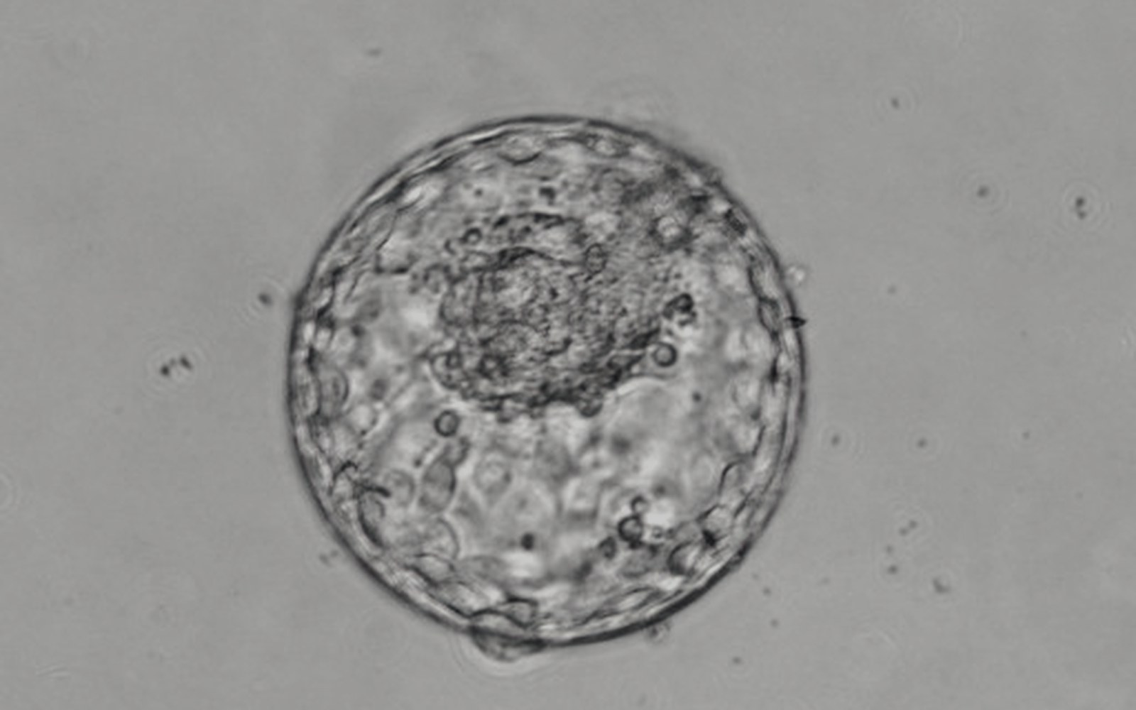 Blastocyst Culture & Transfer