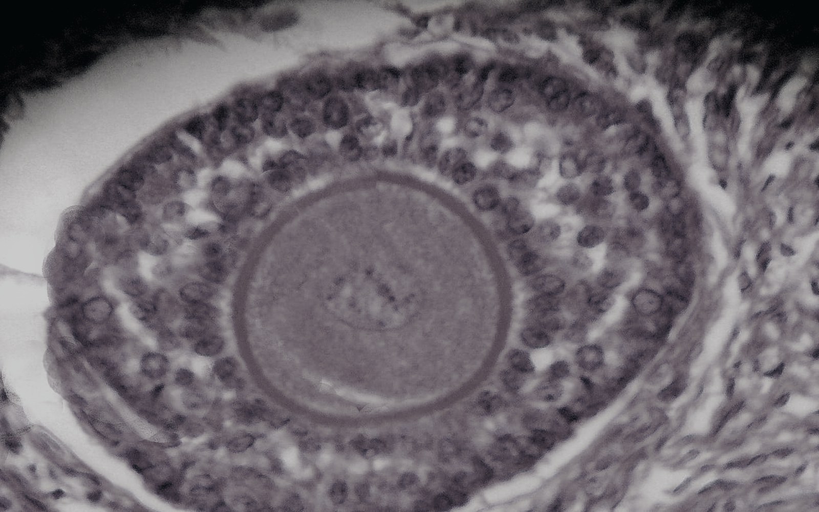Ovulation Induction