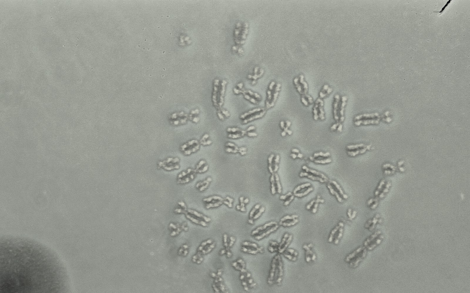 Preimplantation Genetic Testing (PGT)