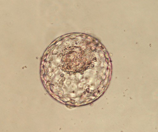 Blastocyst Culture & Transfer