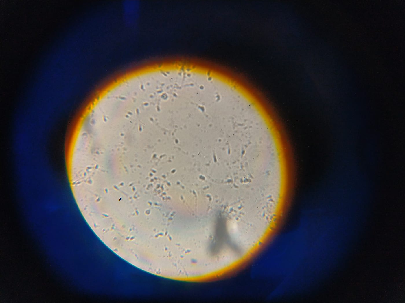 Male Infertility Treatment
